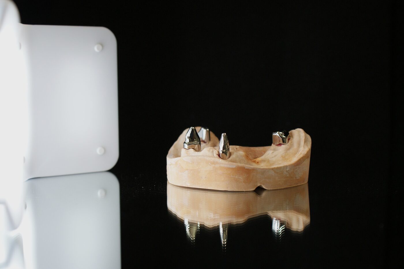 Implantatmodell mit pr&auml;zise gefertigten Abutments