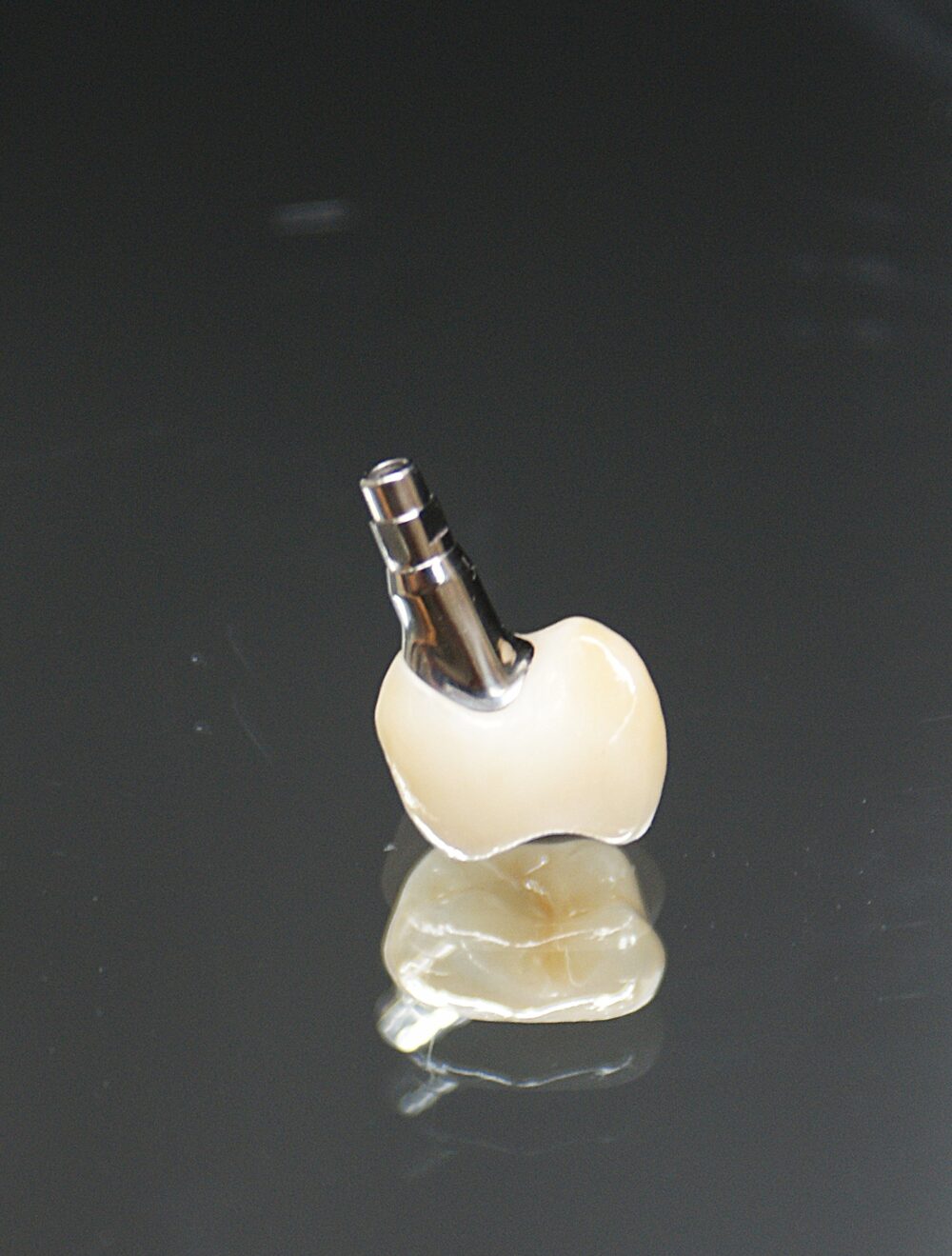 Vollkeramische Krone auf Implantatabutment