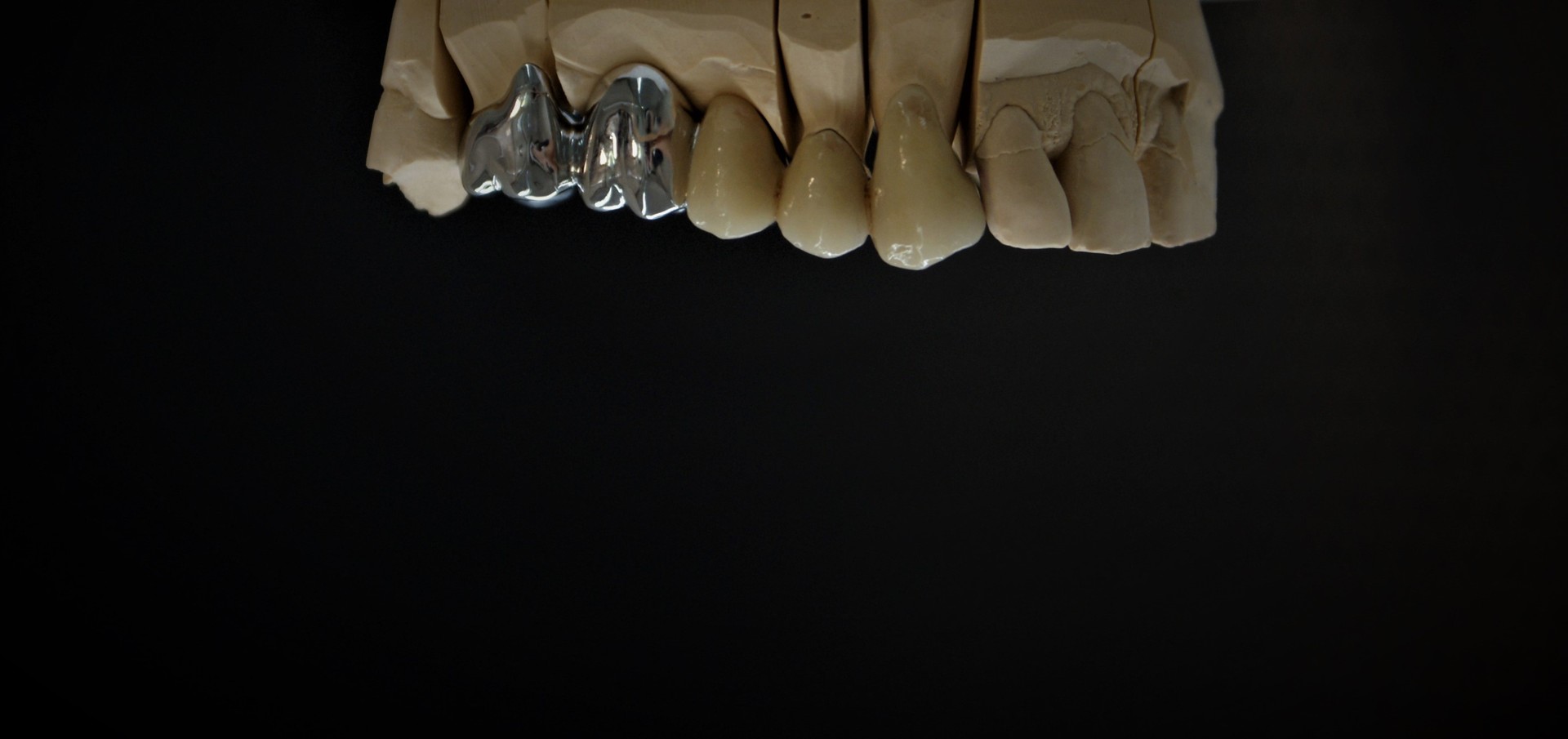 Einblick ins Dentallabor von Bumiller Zahntechnik &ndash; Bild 4