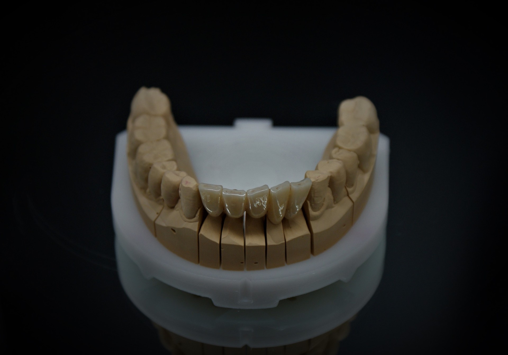 Einblick ins Dentallabor von Bumiller Zahntechnik &ndash; Bild 6
