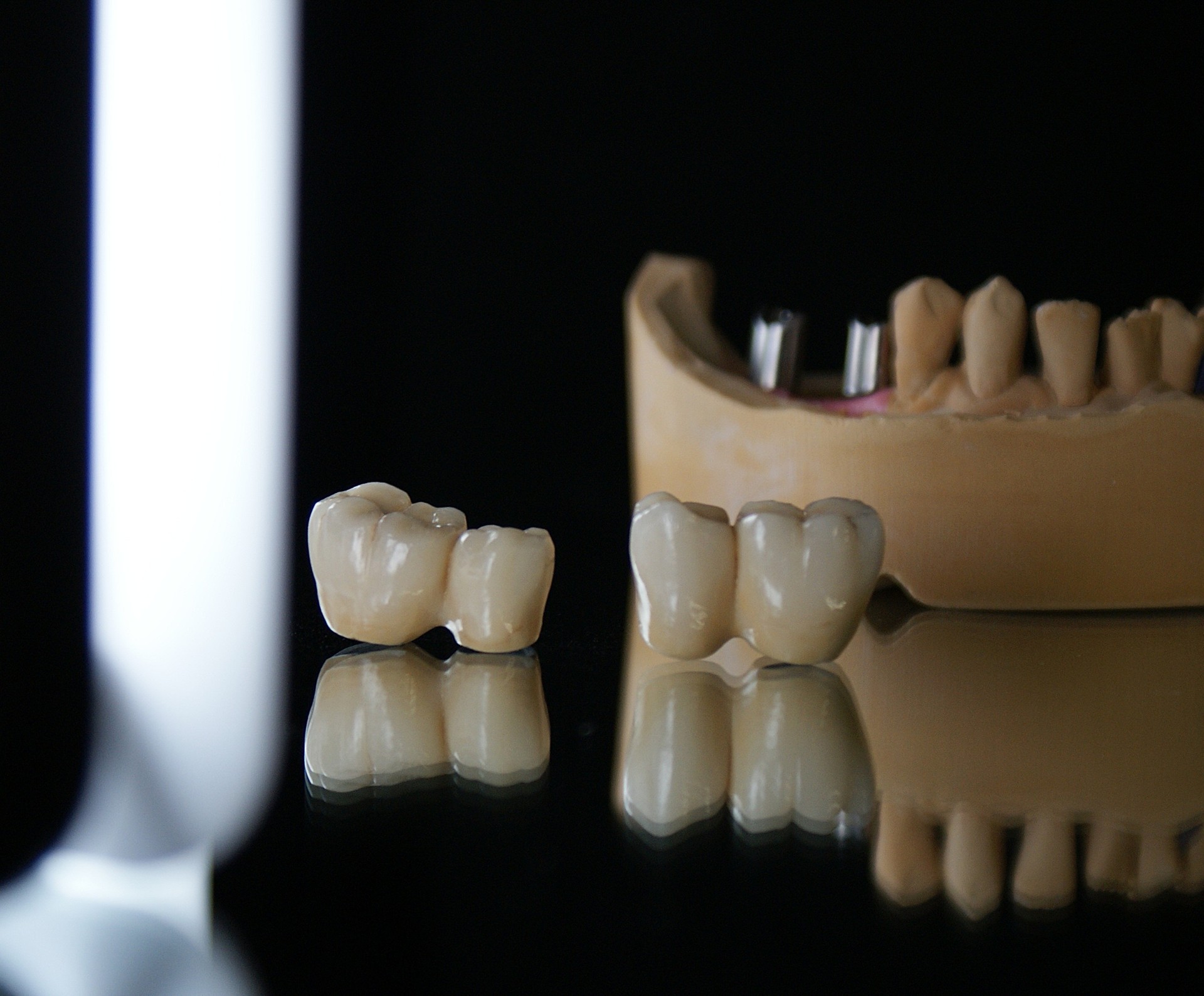 Einblick ins Dentallabor von Bumiller Zahntechnik &ndash; Bild 13