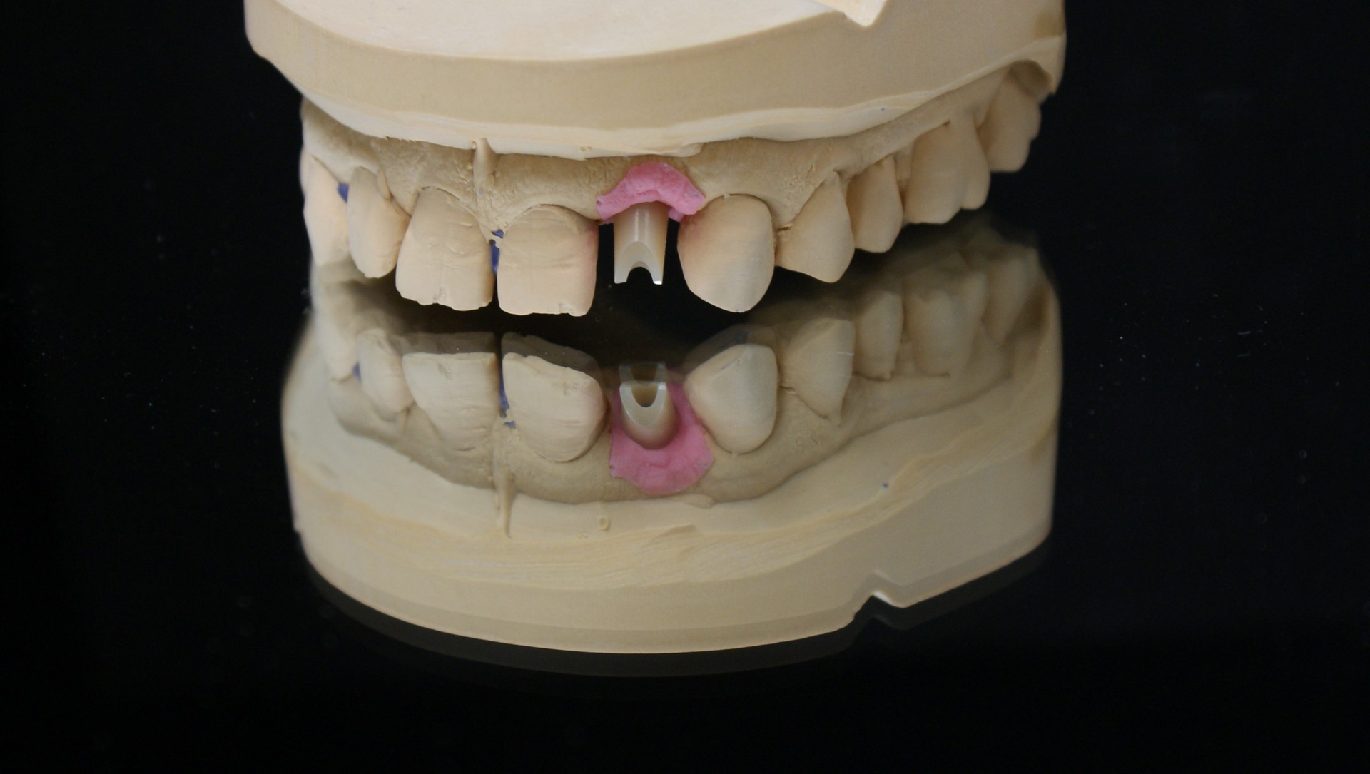 Einblick ins Dentallabor von Bumiller Zahntechnik &ndash; Bild 20