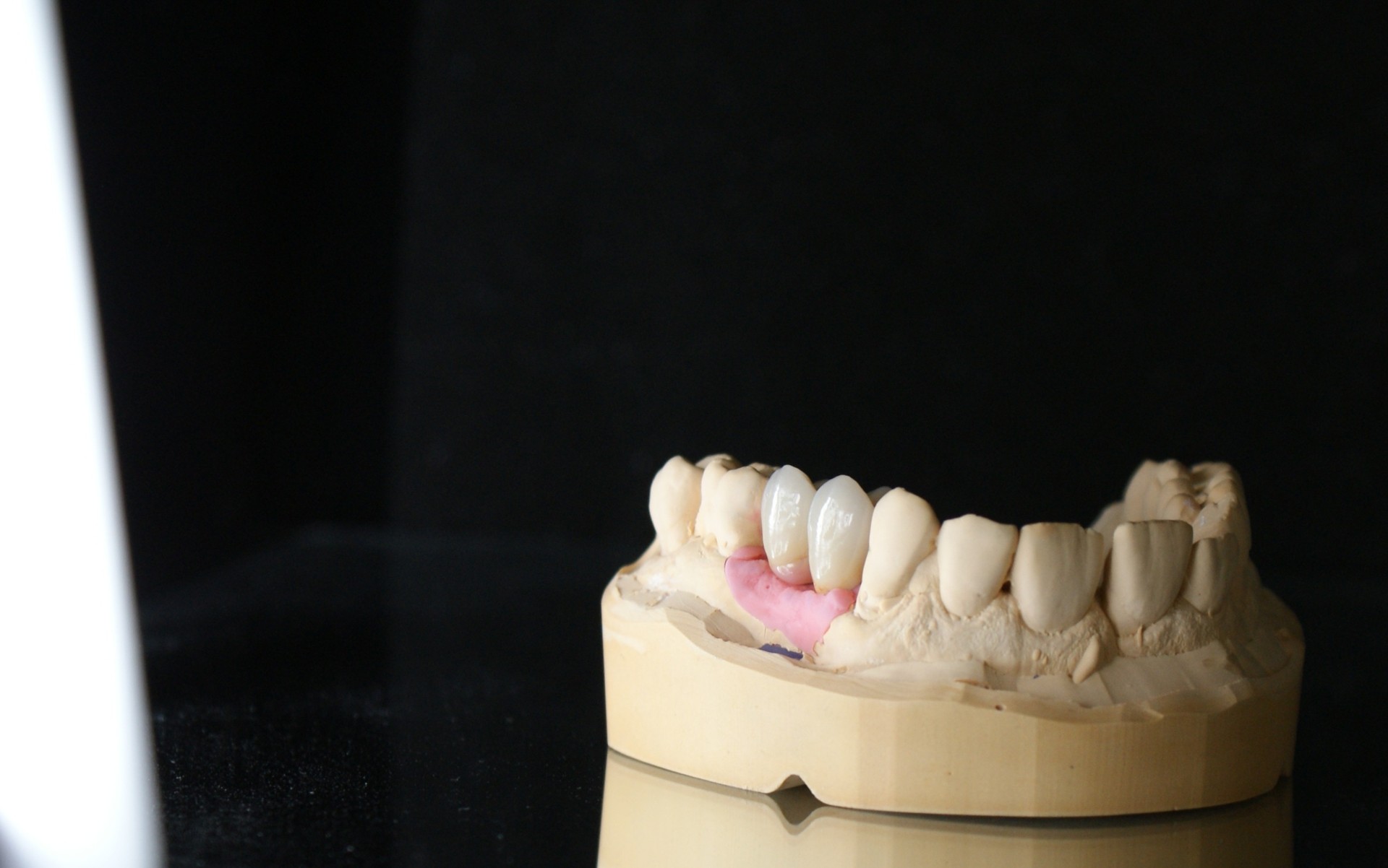 Einblick ins Dentallabor von Bumiller Zahntechnik &ndash; Bild 21