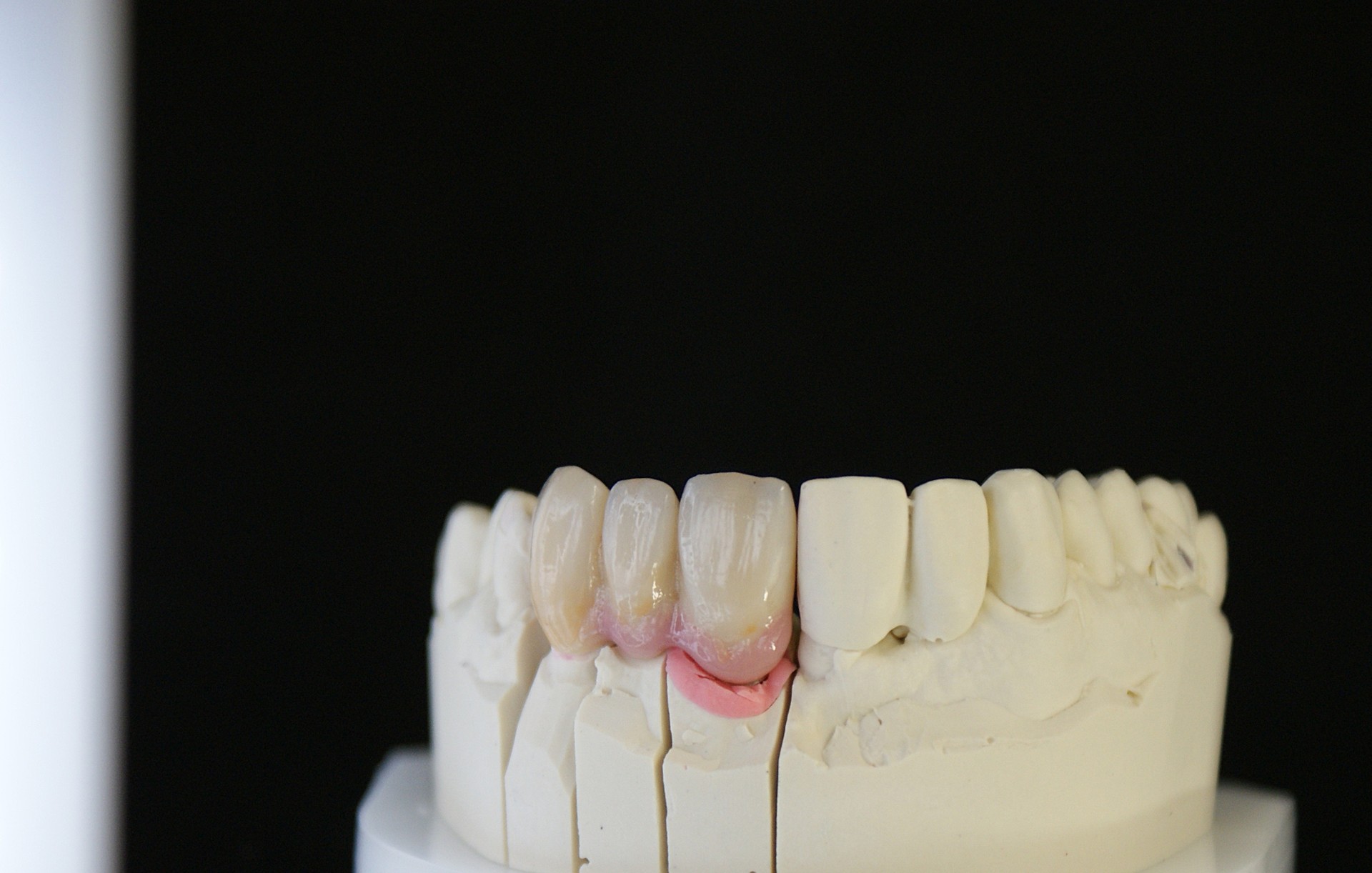 Einblick ins Dentallabor von Bumiller Zahntechnik &ndash; Bild 27