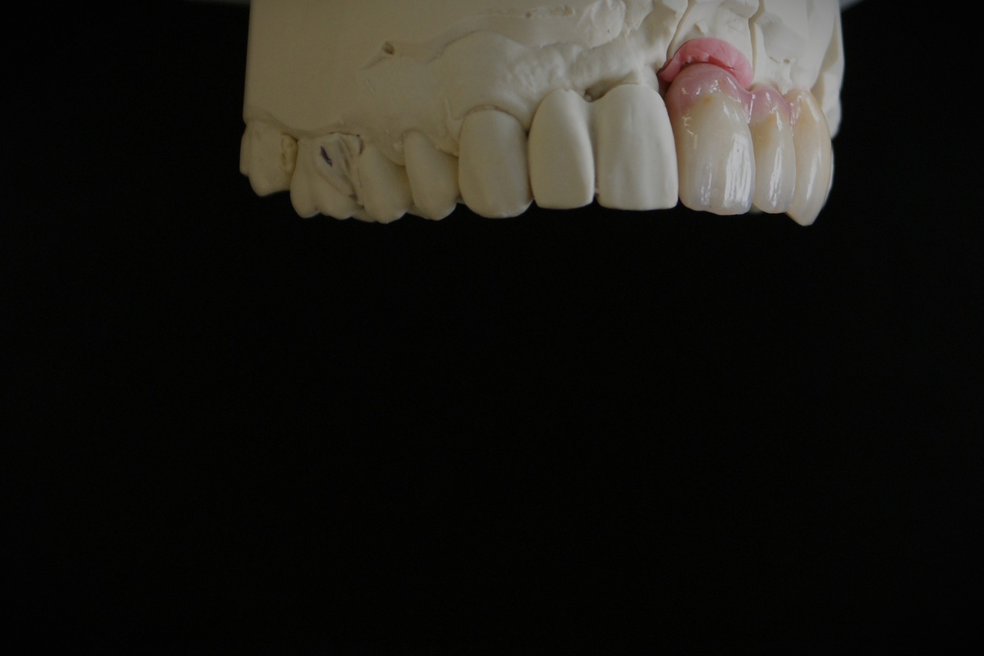Einblick ins Dentallabor von Bumiller Zahntechnik &ndash; Bild 28
