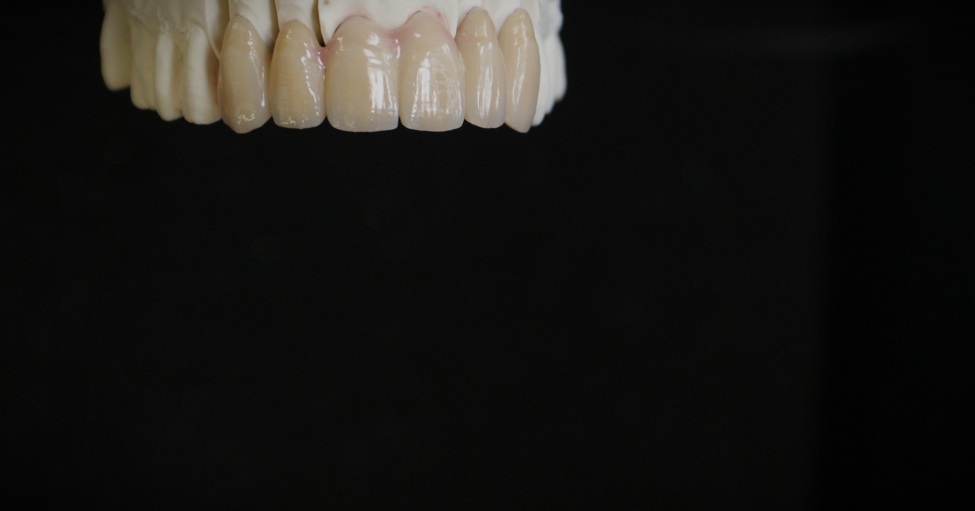 Einblick ins Dentallabor von Bumiller Zahntechnik &ndash; Bild 29