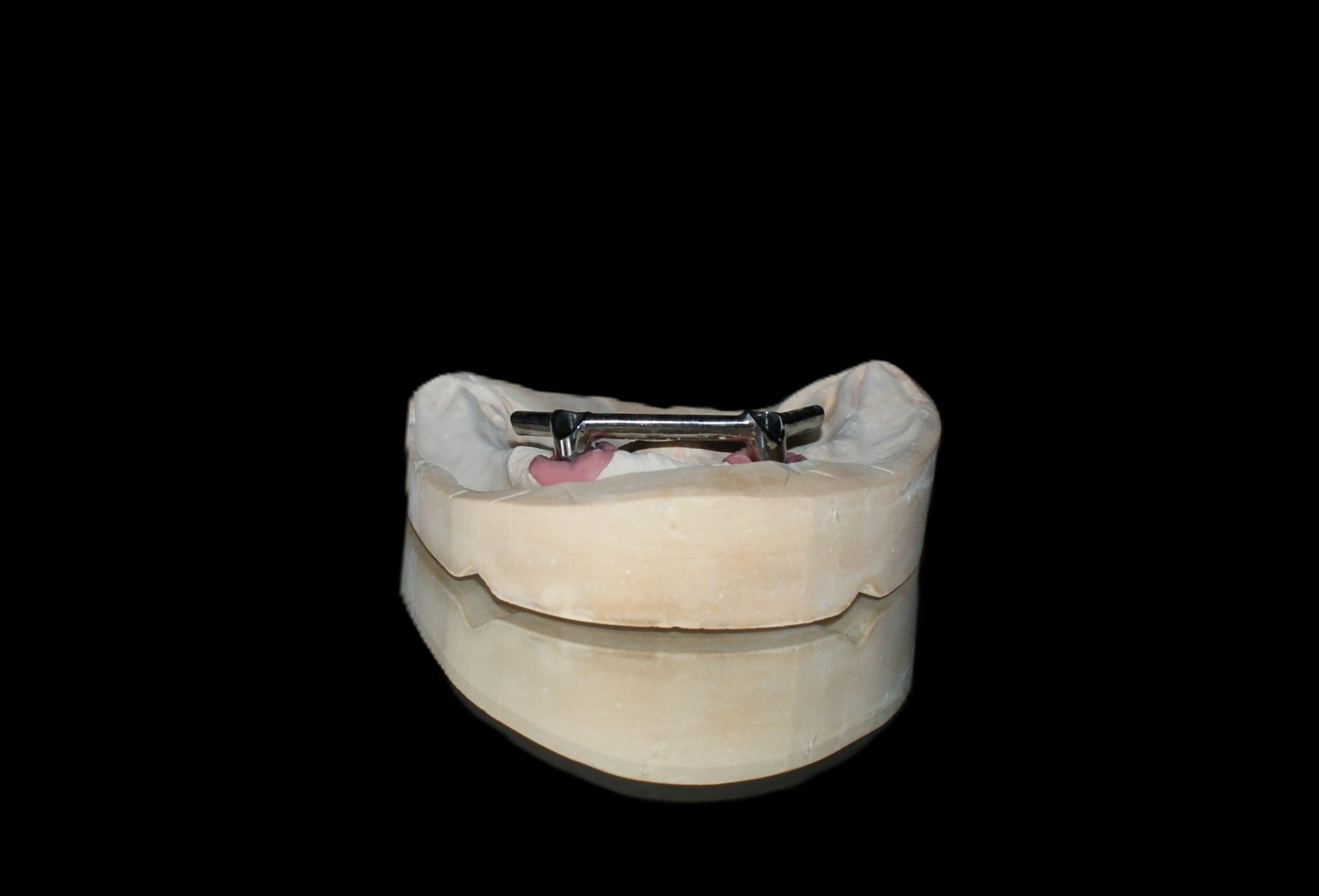 Einblick ins Dentallabor von Bumiller Zahntechnik &ndash; Bild 30