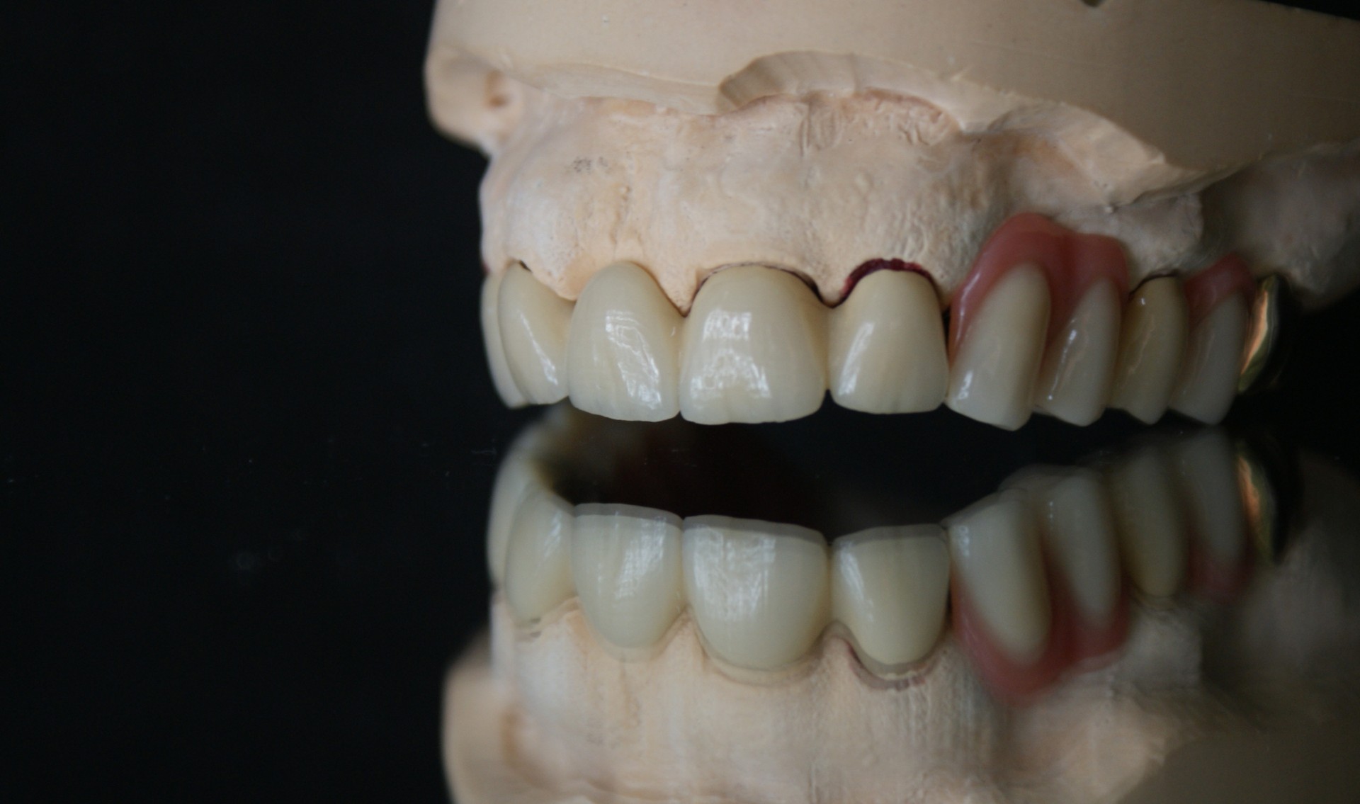 Einblick ins Dentallabor von Bumiller Zahntechnik &ndash; Bild 38