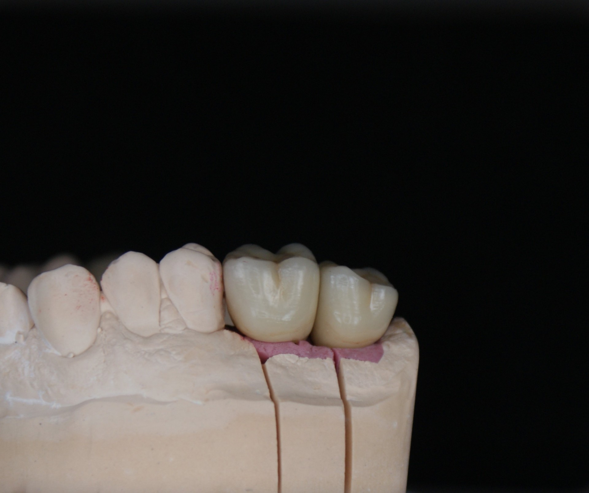 Einblick ins Dentallabor von Bumiller Zahntechnik &ndash; Bild 39