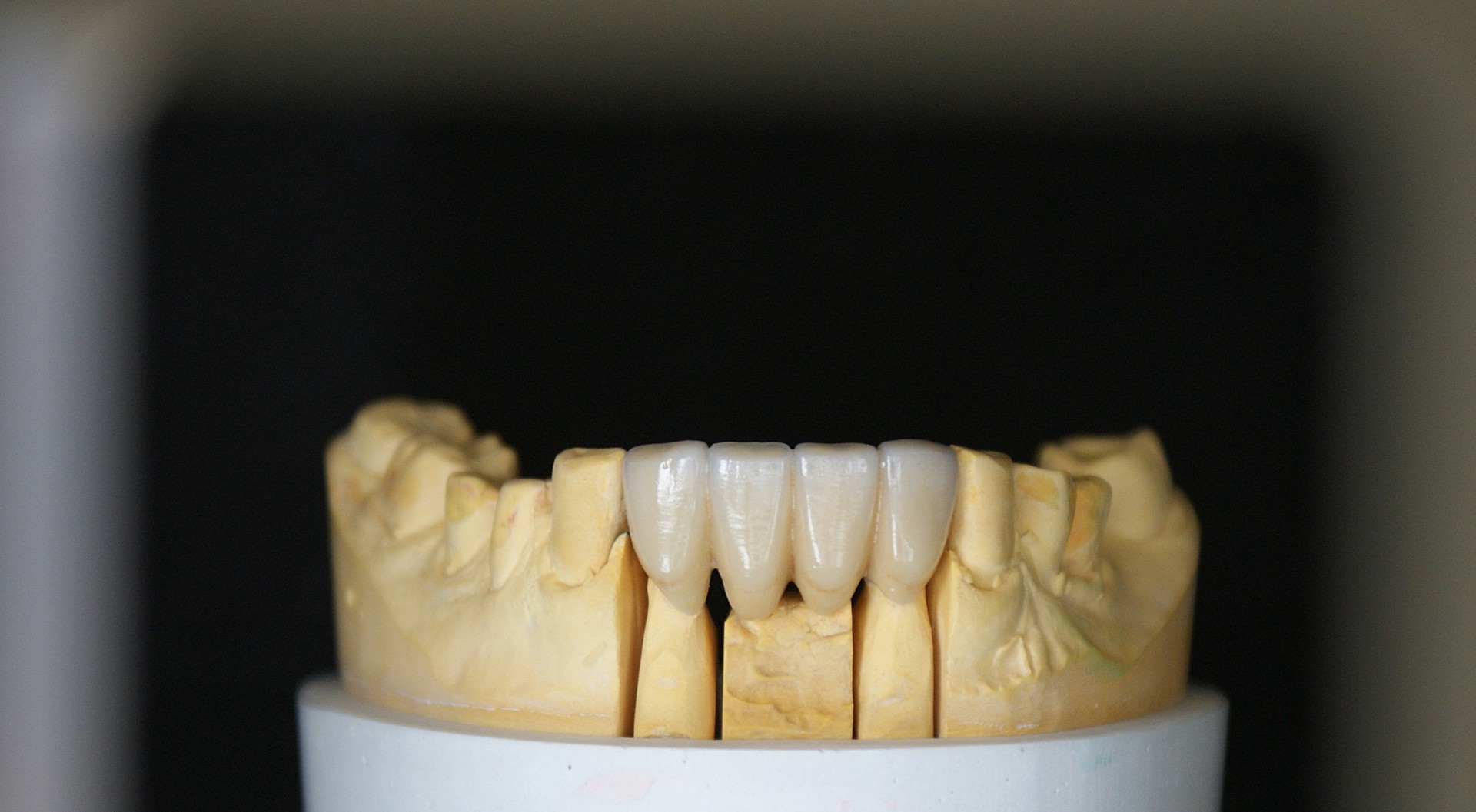 Einblick ins Dentallabor von Bumiller Zahntechnik &ndash; Bild 42