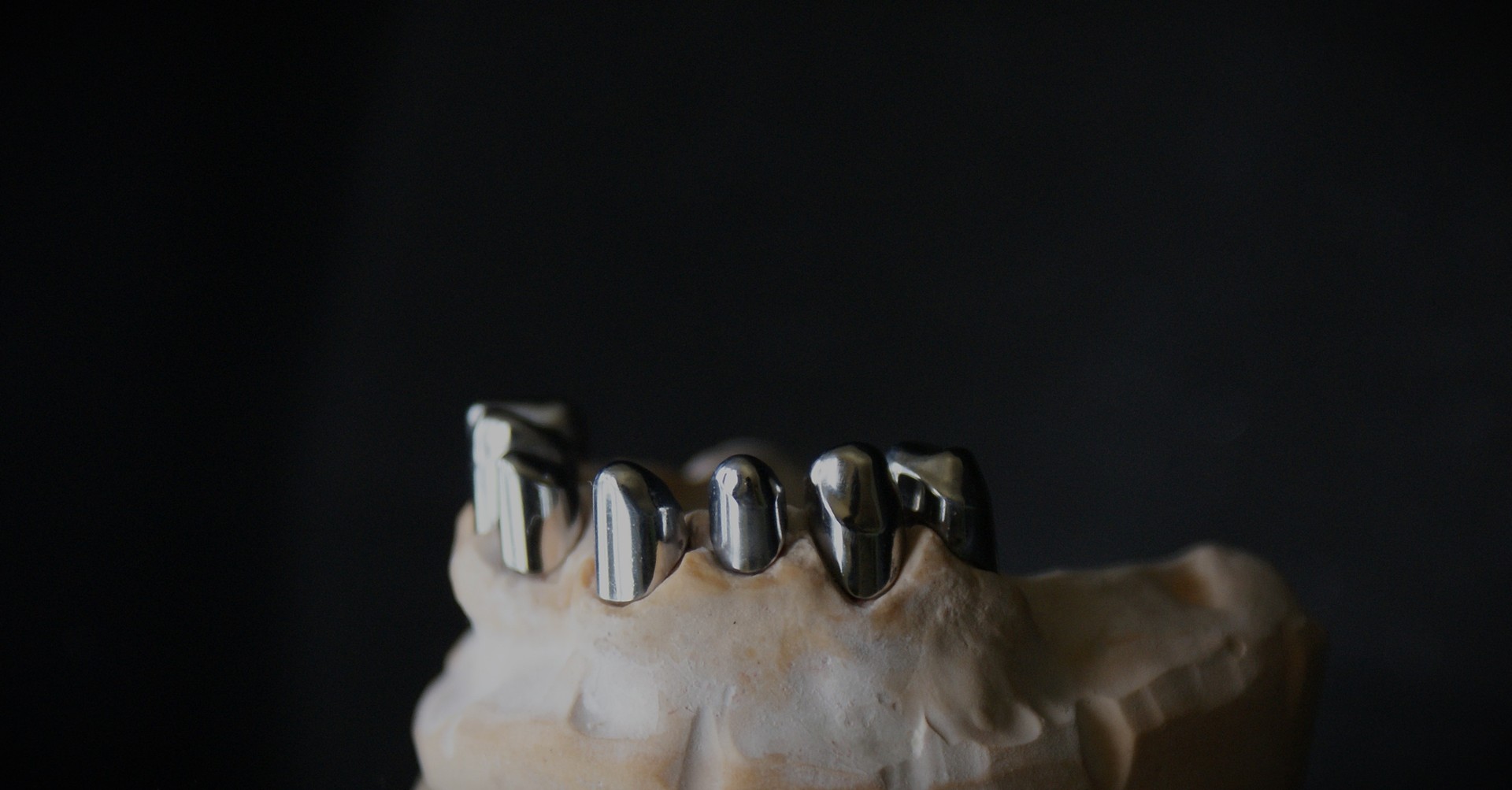 Einblick ins Dentallabor von Bumiller Zahntechnik &ndash; Bild 43