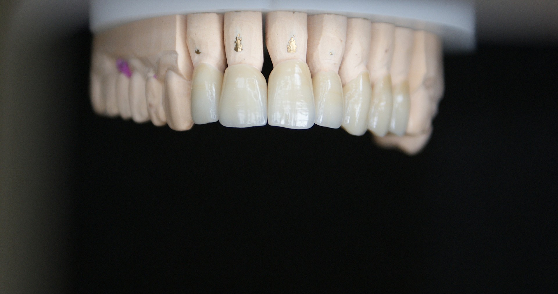 Einblick ins Dentallabor von Bumiller Zahntechnik &ndash; Bild 46