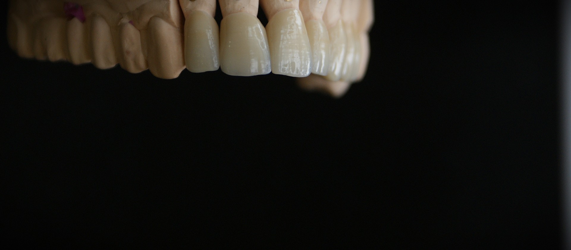 Einblick ins Dentallabor von Bumiller Zahntechnik &ndash; Bild 47