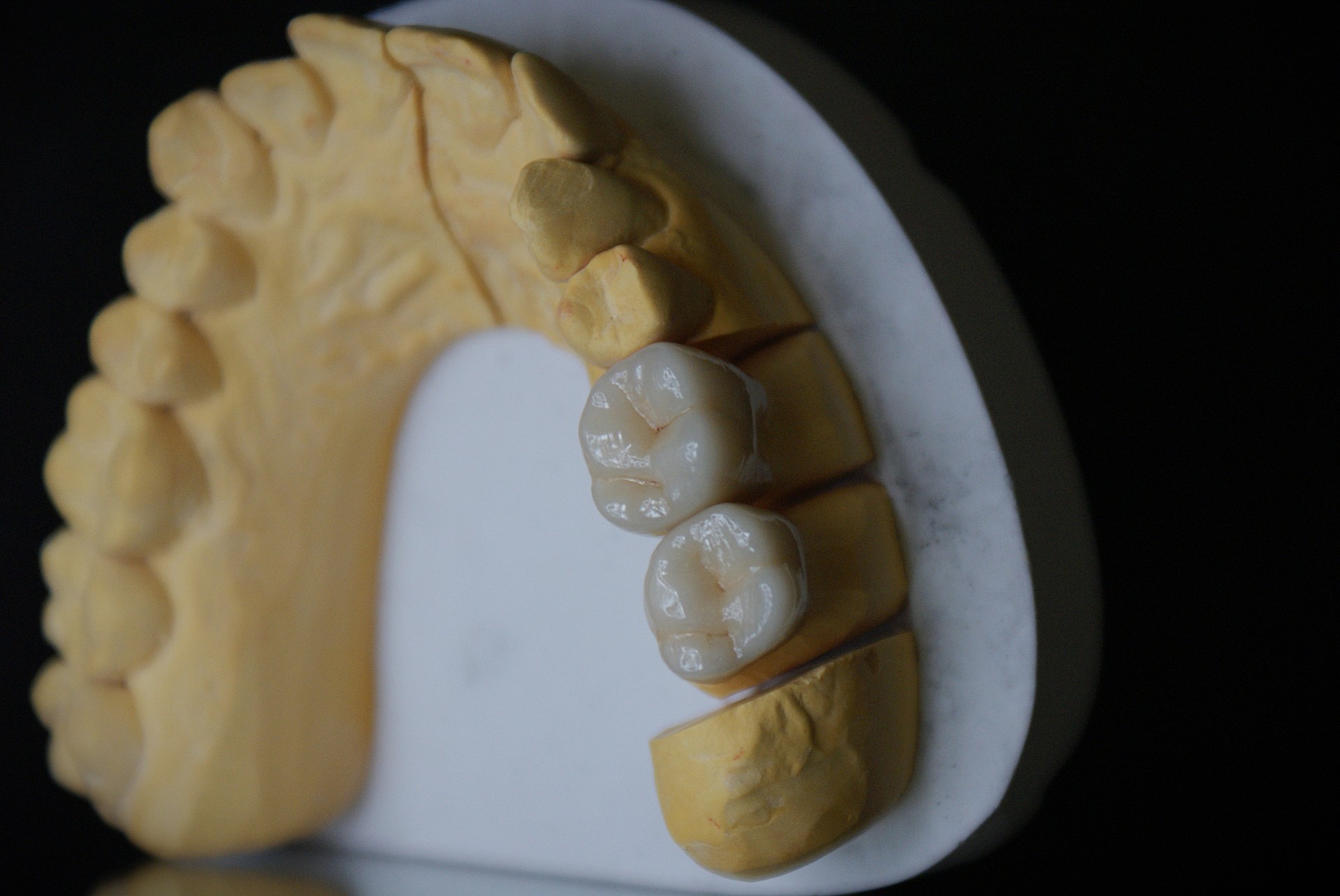 Einblick ins Dentallabor von Bumiller Zahntechnik &ndash; Bild 50