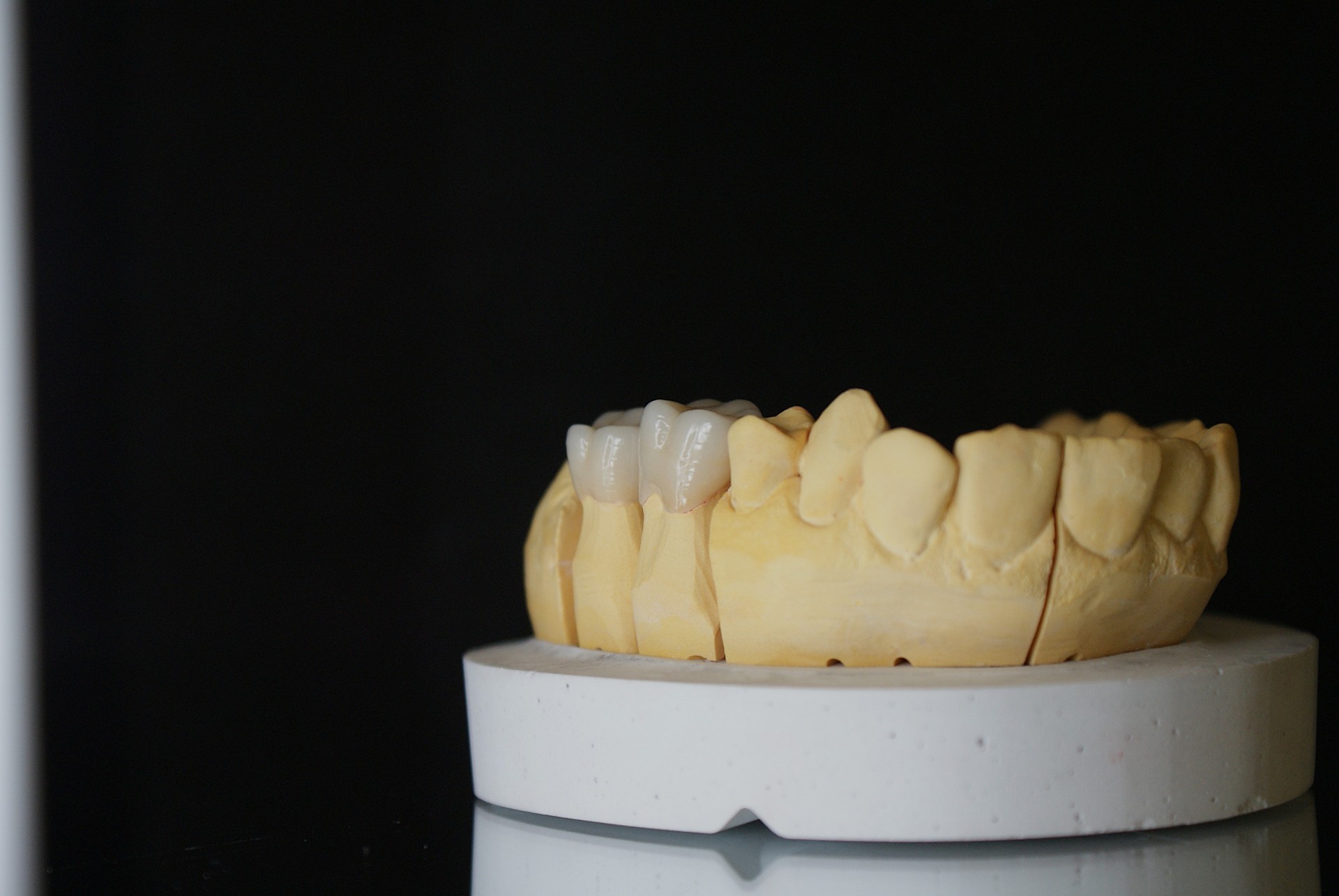 Einblick ins Dentallabor von Bumiller Zahntechnik &ndash; Bild 51
