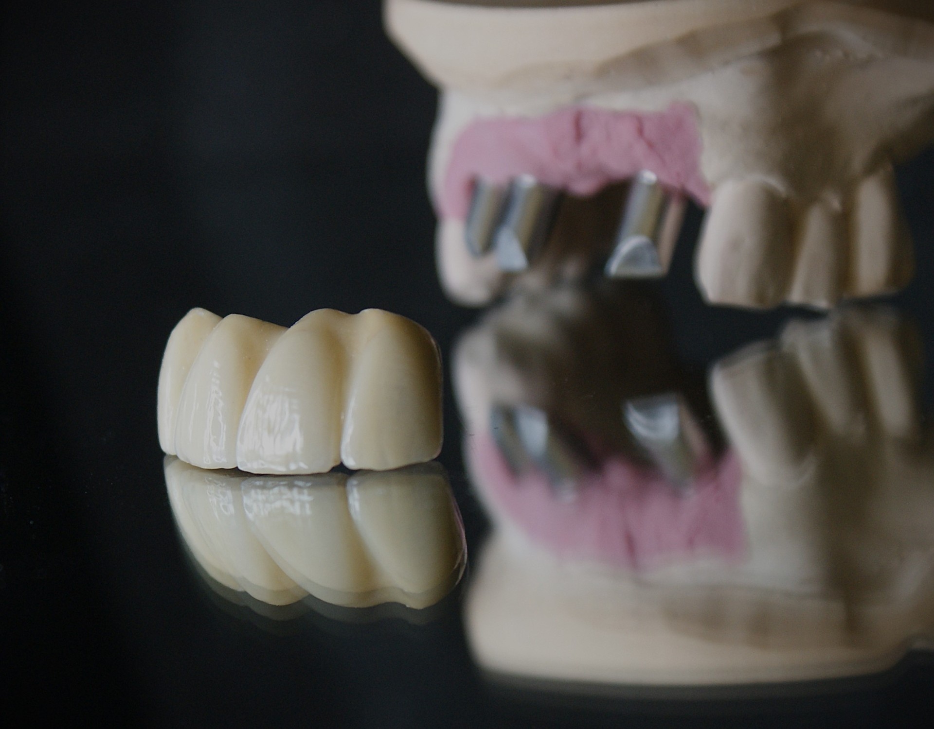 Einblick ins Dentallabor von Bumiller Zahntechnik &ndash; Bild 53