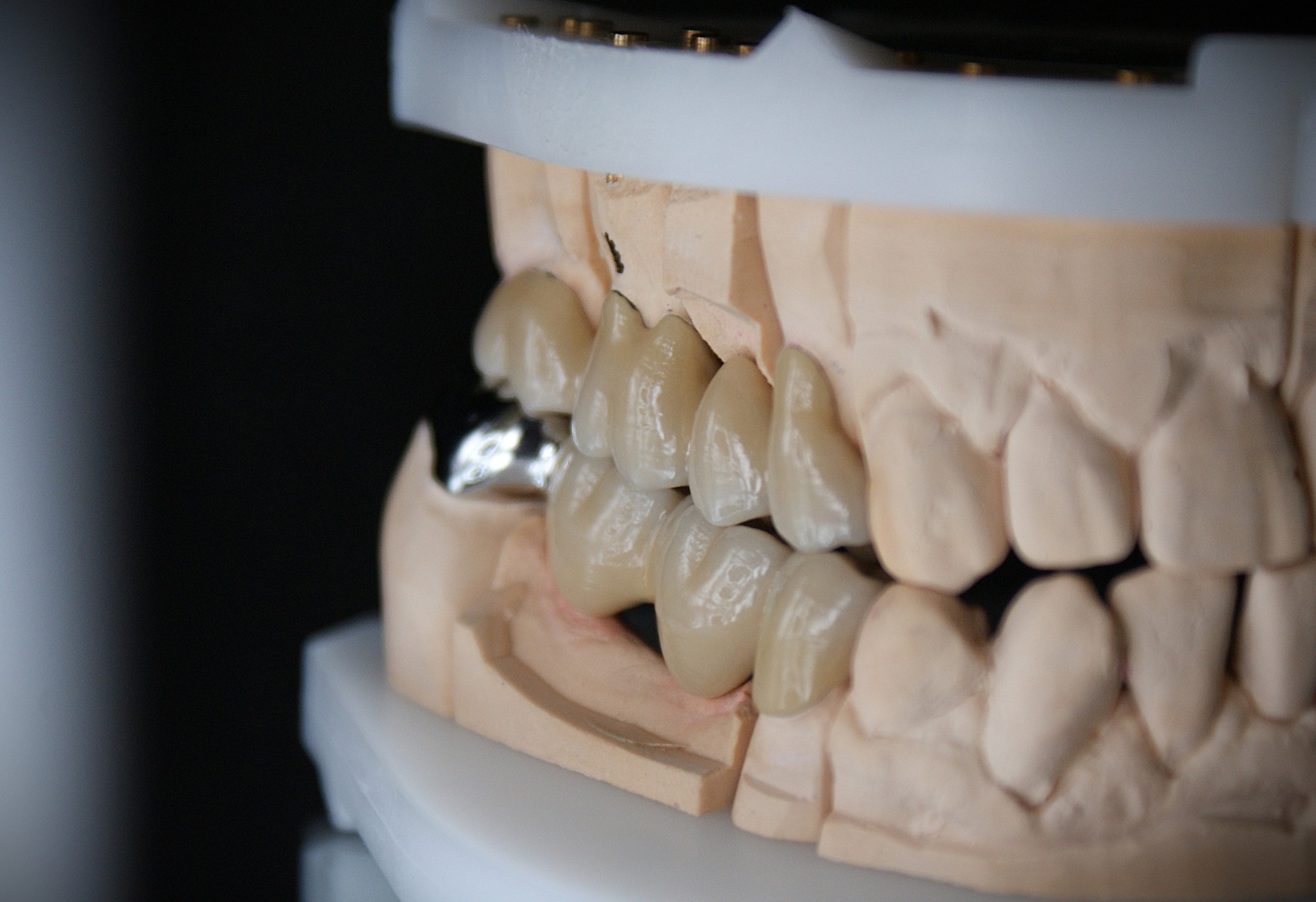 Einblick ins Dentallabor von Bumiller Zahntechnik &ndash; Bild 54