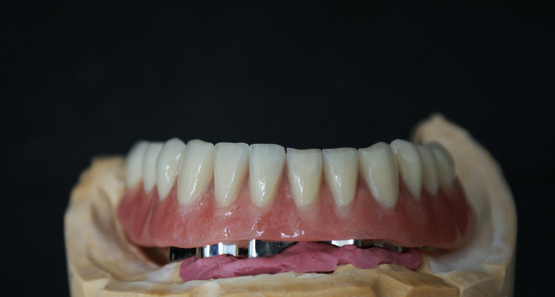 Einblick ins Dentallabor von Bumiller Zahntechnik &ndash; Bild 56