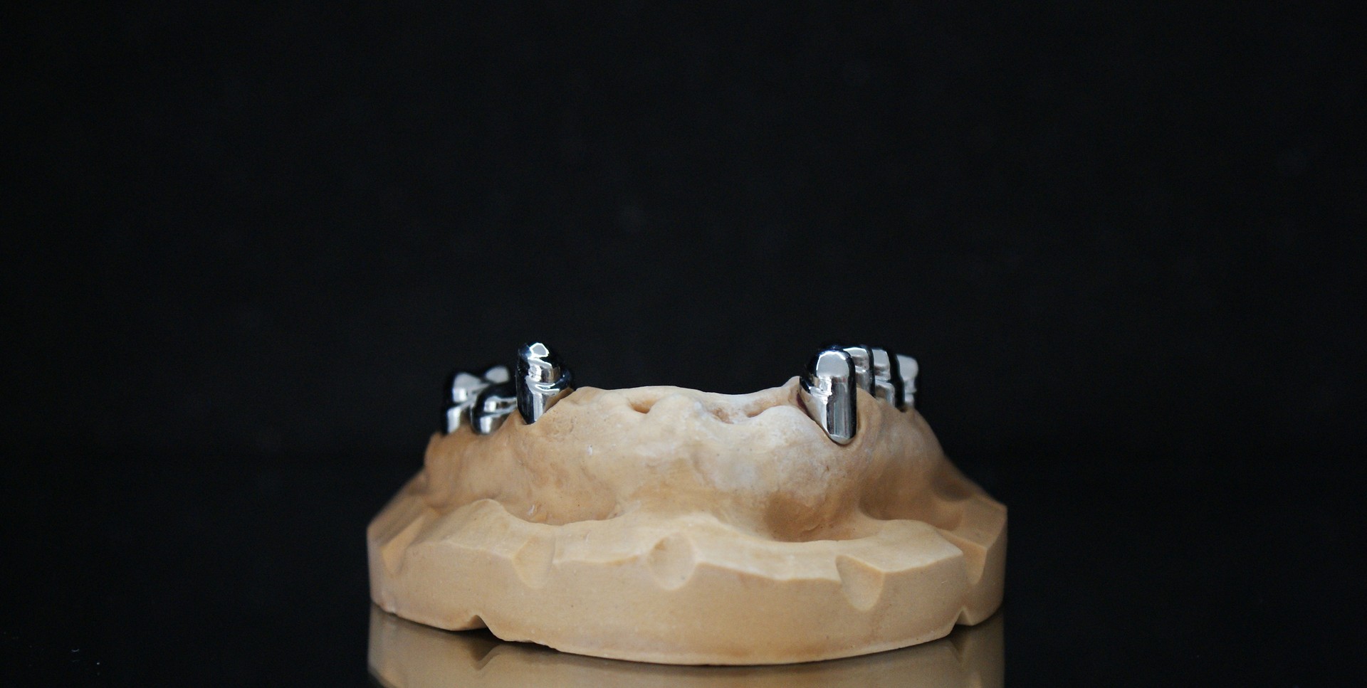 Einblick ins Dentallabor von Bumiller Zahntechnik &ndash; Bild 57