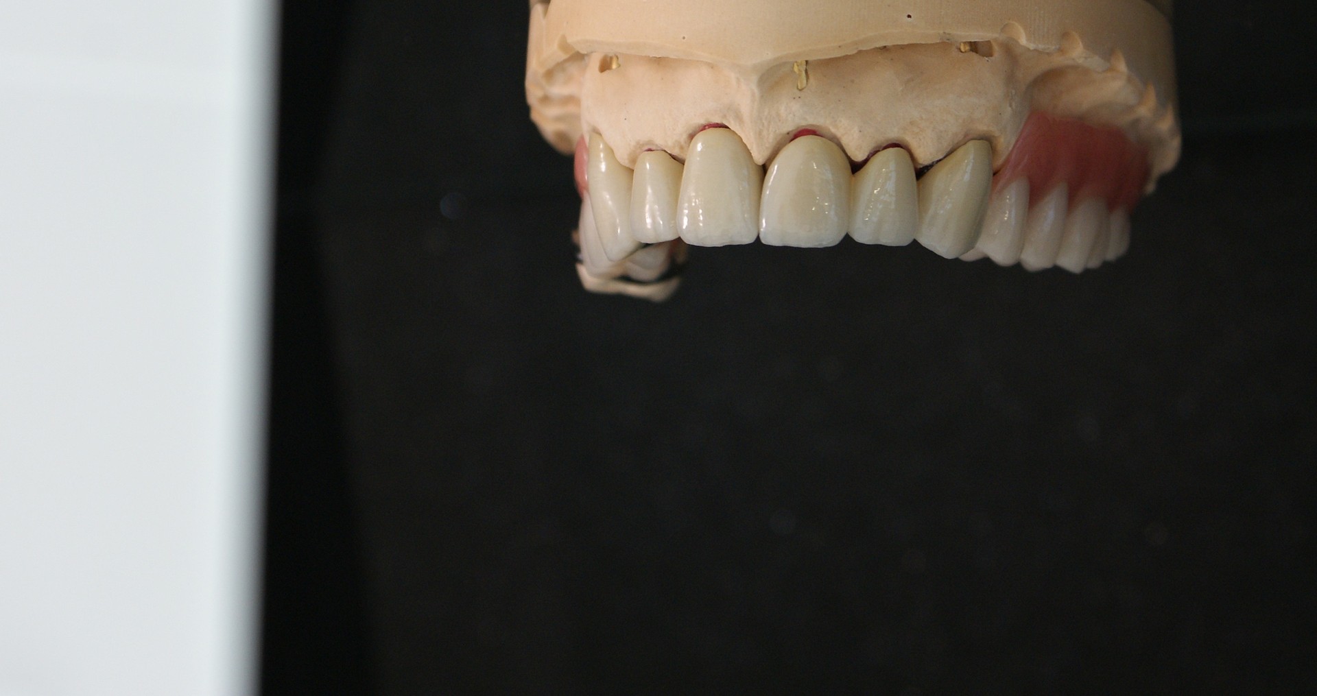 Einblick ins Dentallabor von Bumiller Zahntechnik &ndash; Bild 60