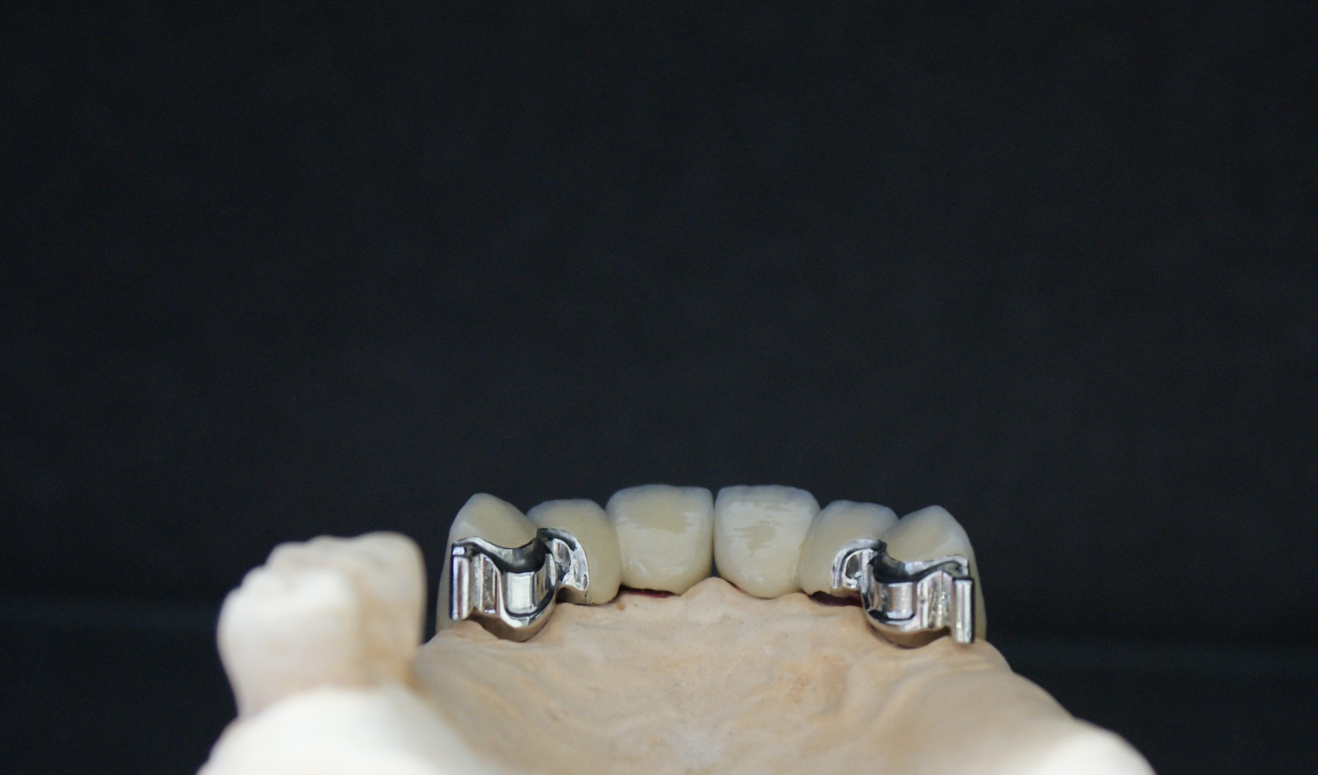 Einblick ins Dentallabor von Bumiller Zahntechnik &ndash; Bild 61