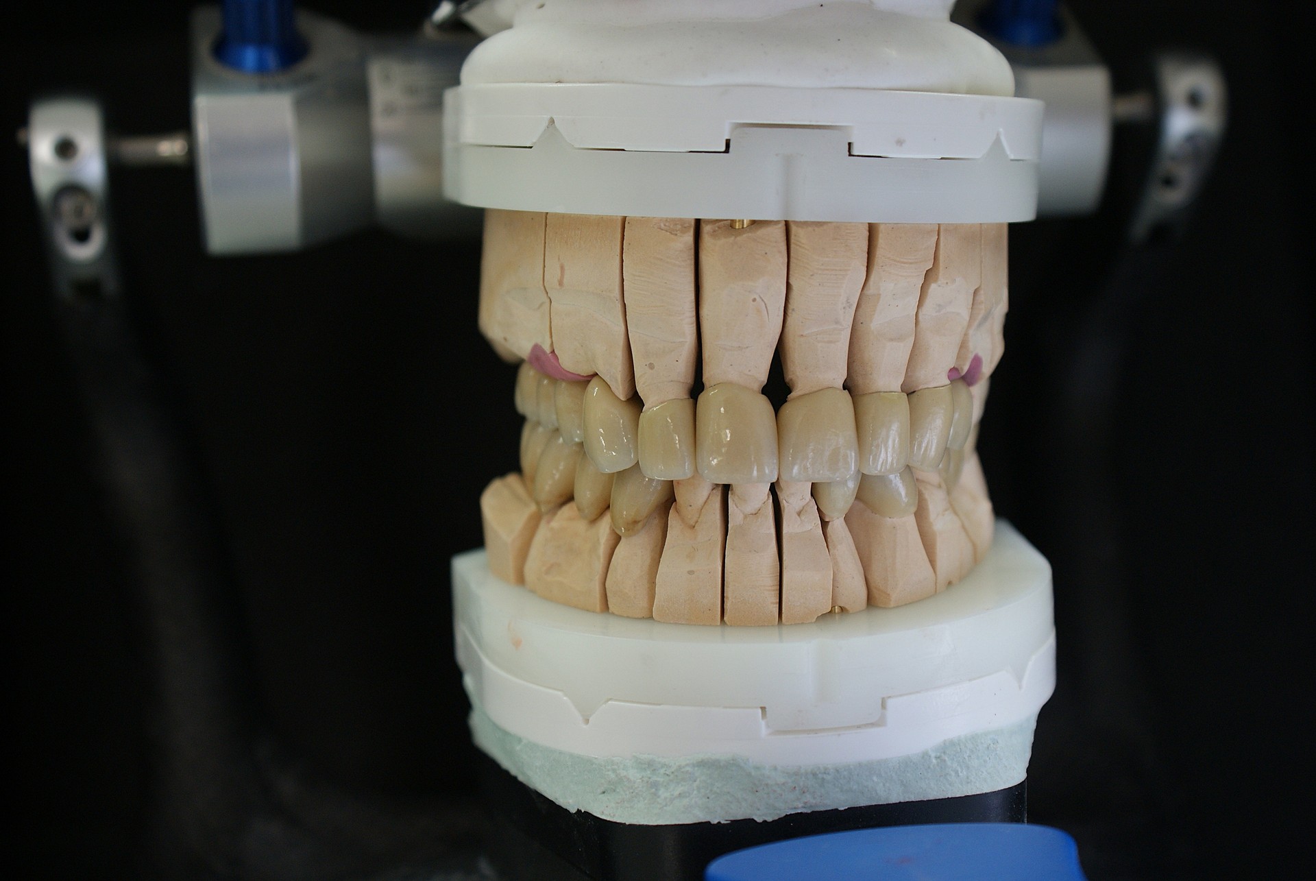 Einblick ins Dentallabor von Bumiller Zahntechnik &ndash; Bild 62