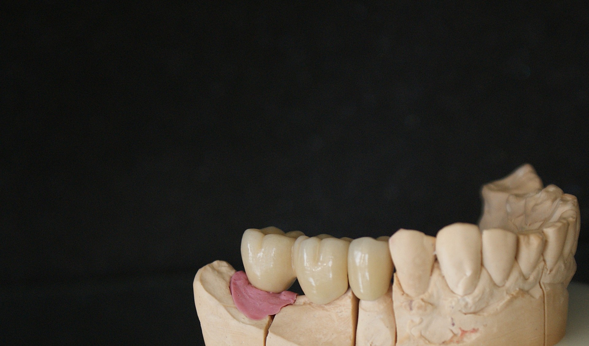 Einblick ins Dentallabor von Bumiller Zahntechnik &ndash; Bild 63