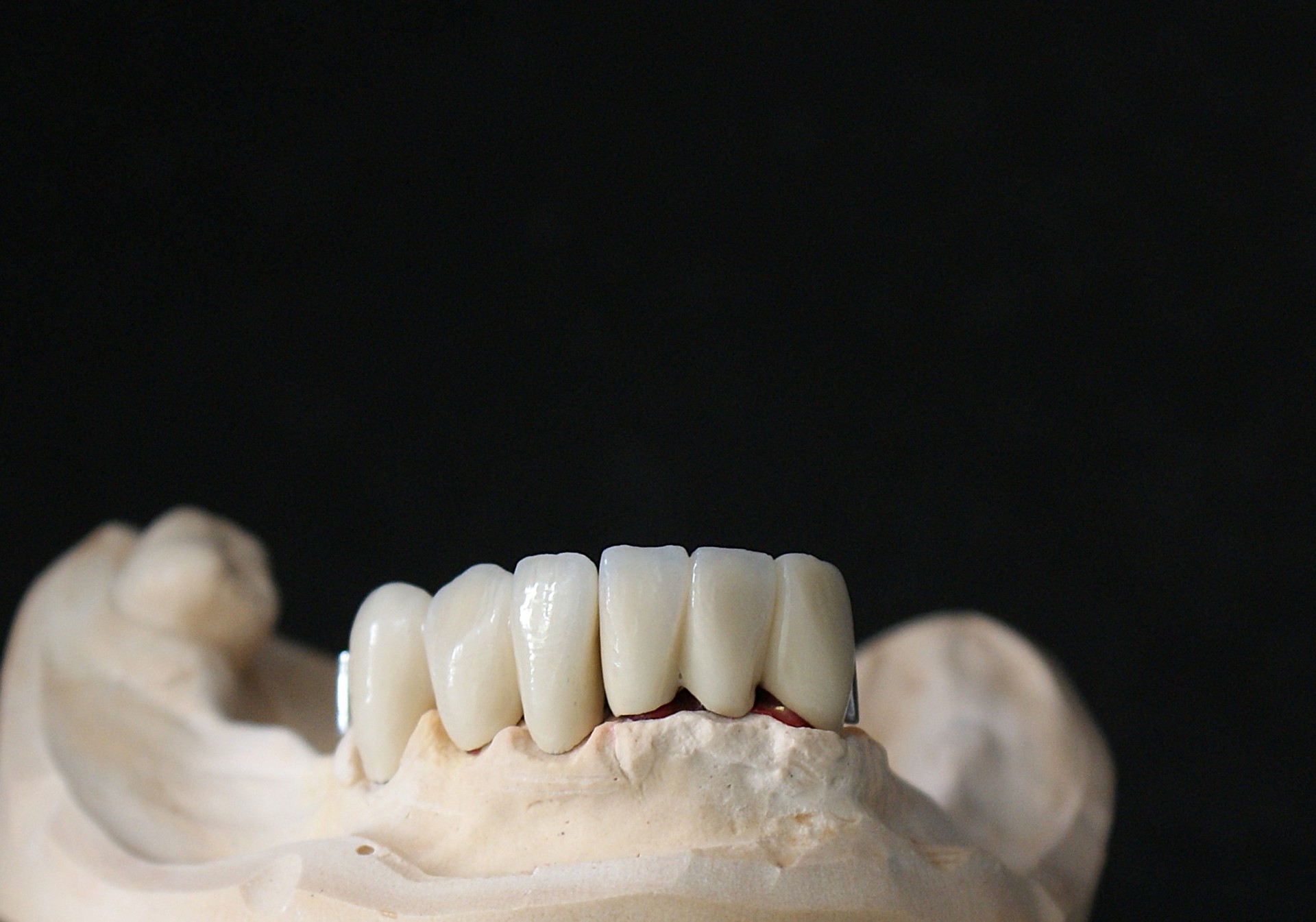 Einblick ins Dentallabor von Bumiller Zahntechnik &ndash; Bild 64