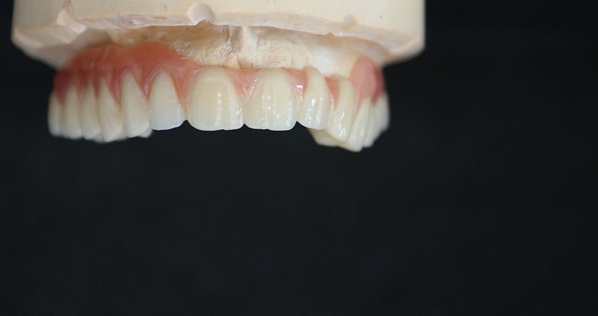 Einblick ins Dentallabor von Bumiller Zahntechnik &ndash; Bild 66