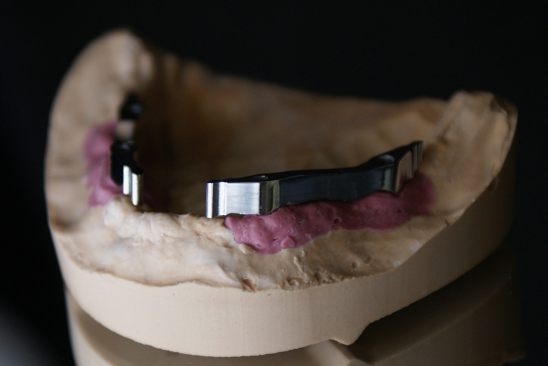 Einblick ins Dentallabor von Bumiller Zahntechnik &ndash; Bild 68