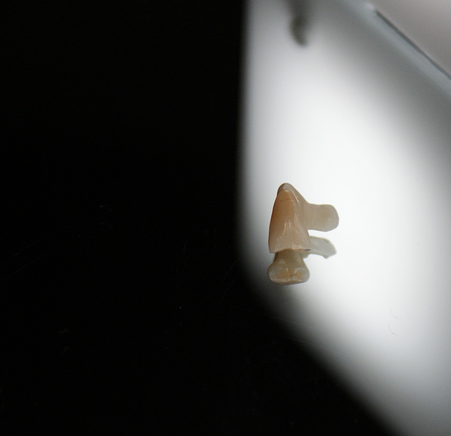 Einblick ins Dentallabor von Bumiller Zahntechnik &ndash; Bild 73