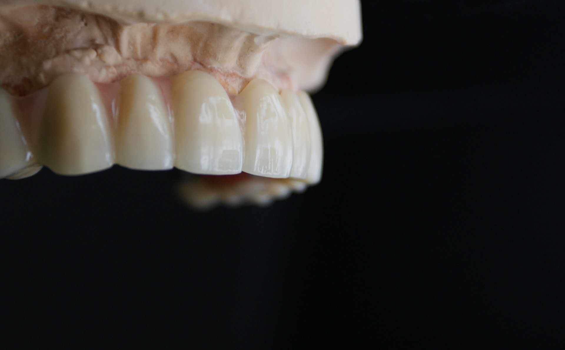 Einblick ins Dentallabor von Bumiller Zahntechnik &ndash; Bild 75