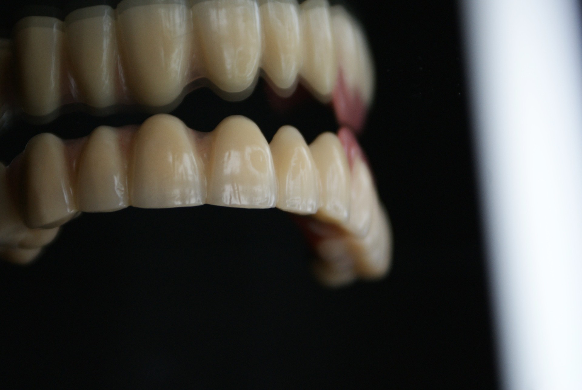 Einblick ins Dentallabor von Bumiller Zahntechnik &ndash; Bild 76